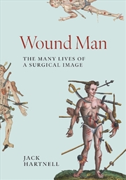 Buy Wound Man