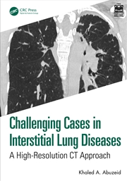 Buy Challenging Cases In Interstitial Lung Diseases A High-Resolution Ct Approach
