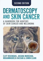 Buy Dermatoscopy and Skin Cancer, second edition