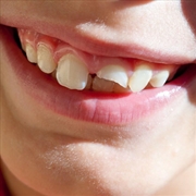 Buy Smiling Through The Pain