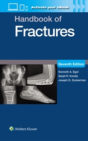 Buy Handbook Of Fractures: Print + Ebook With Multimedia