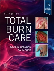 Buy Total Burn Care