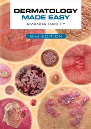 Buy Dermatology Made Easy Second Edition