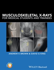 Buy Musculoskeletal X-Rays For Medical Students And Trainees