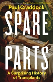 Buy Spare Parts : A Surprising History Of Transplants