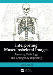 Buy Interpreting Musculoskeletal I