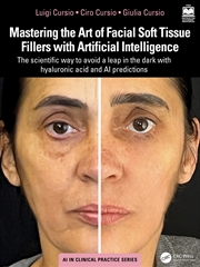 Buy Mastering the Art of Facial Soft Tissue Fillers with Artificial Intelligence