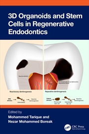 Buy 3D Organoids and Stem Cells in Regenerative Endodontics