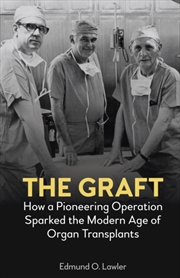 Buy The Graft : How a Pioneering Operation Sparked the Modern Age of Organ Transplants
