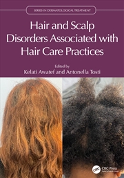 Buy Hair and Scalp Disorders Associated with Hair Care Practices
