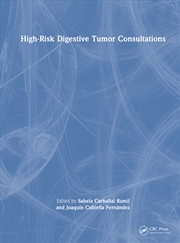 Buy High-Risk Digestive Tumor Consultations