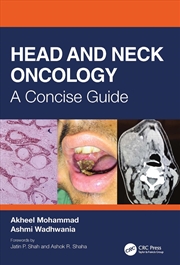 Buy Head and Neck Oncology