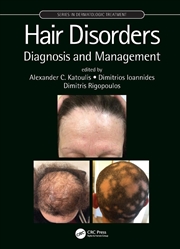 Buy Hair Disorders