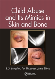 Buy Child Abuse and its Mimics in Skin and Bone