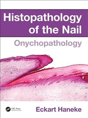 Buy Histopathology of the Nail