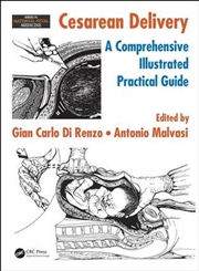 Buy Cesarean Delivery