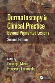 Buy Dermatoscopy in Clinical Practice