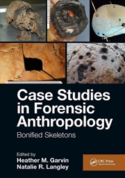 Buy Case Studies in Forensic Anthropology