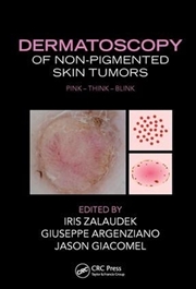 Buy Dermatoscopy of Non-Pigmented Skin Tumors