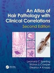Buy Atlas of Hair Pathology with Clinical Correlations