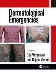 Buy Dermatological Emergencies