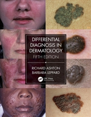 Buy Differential Diagnosis in Dermatology