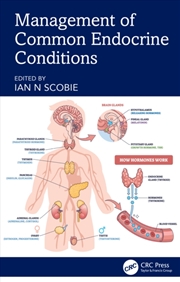 Buy Management of Common Endocrine Conditions