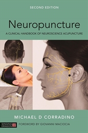Buy Neuropuncture