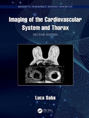 Buy Imaging Of The Cardiovascular System And Thorax