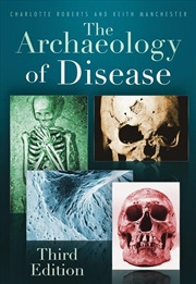 Buy Archaeology of Disease
