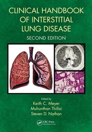 Buy Clinical Handbook of Interstitial Lung Disease