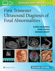 Buy First Trimester Ultrasound Diagnosis Of Fetal Abnormalities