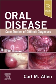 Buy Oral Disease: Case Studies Of Difficult Diagnoses : Case Studies Of Difficult Diagnoses