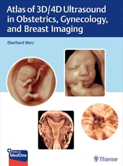 Buy Atlas Of 3D/4D Ultrasound In Obstetrics, Gynecology, And Breast Imaging