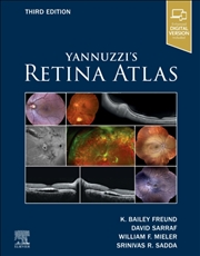 Buy Yannuzzi's Retina Atlas