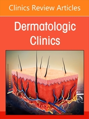 Buy Medical Devices In Dermatology, An Issue Of Dermatologic Clinics : Volume 44-3