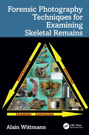 Buy Forensic Photography Techniques for Examining Skeletal Remains