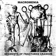 Buy Segments Of Fractured Cranium