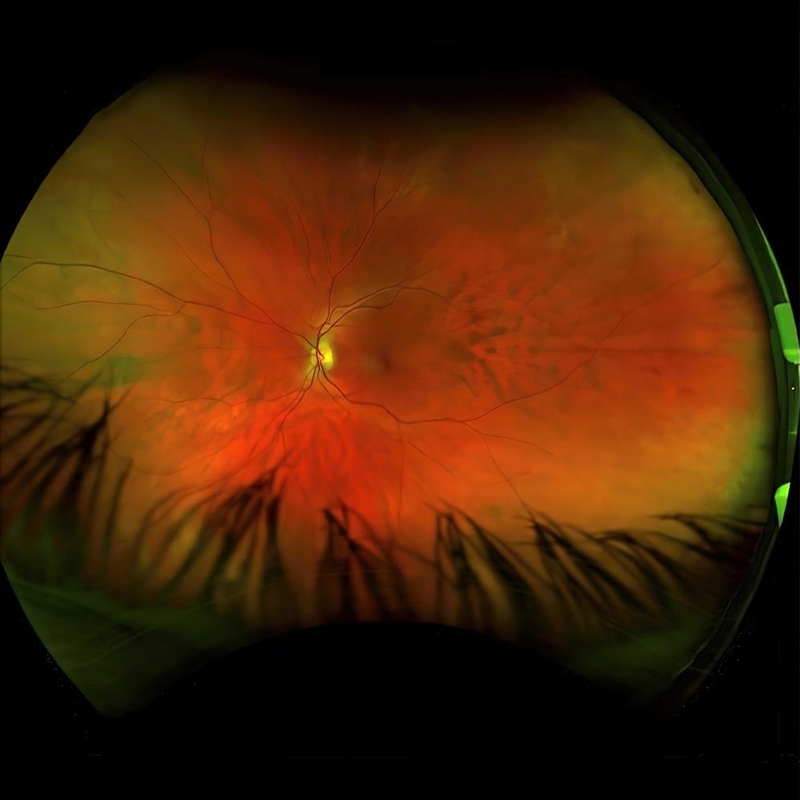 Mirrorcell (Australian Exclusive Yellow Coloured Vinyl)/Product Detail/Rock/Pop