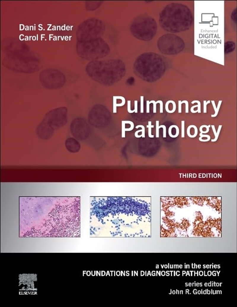 Pulmonary Pathology (Foundations In Diagnostic Pathology)/Product Detail/Family & Health