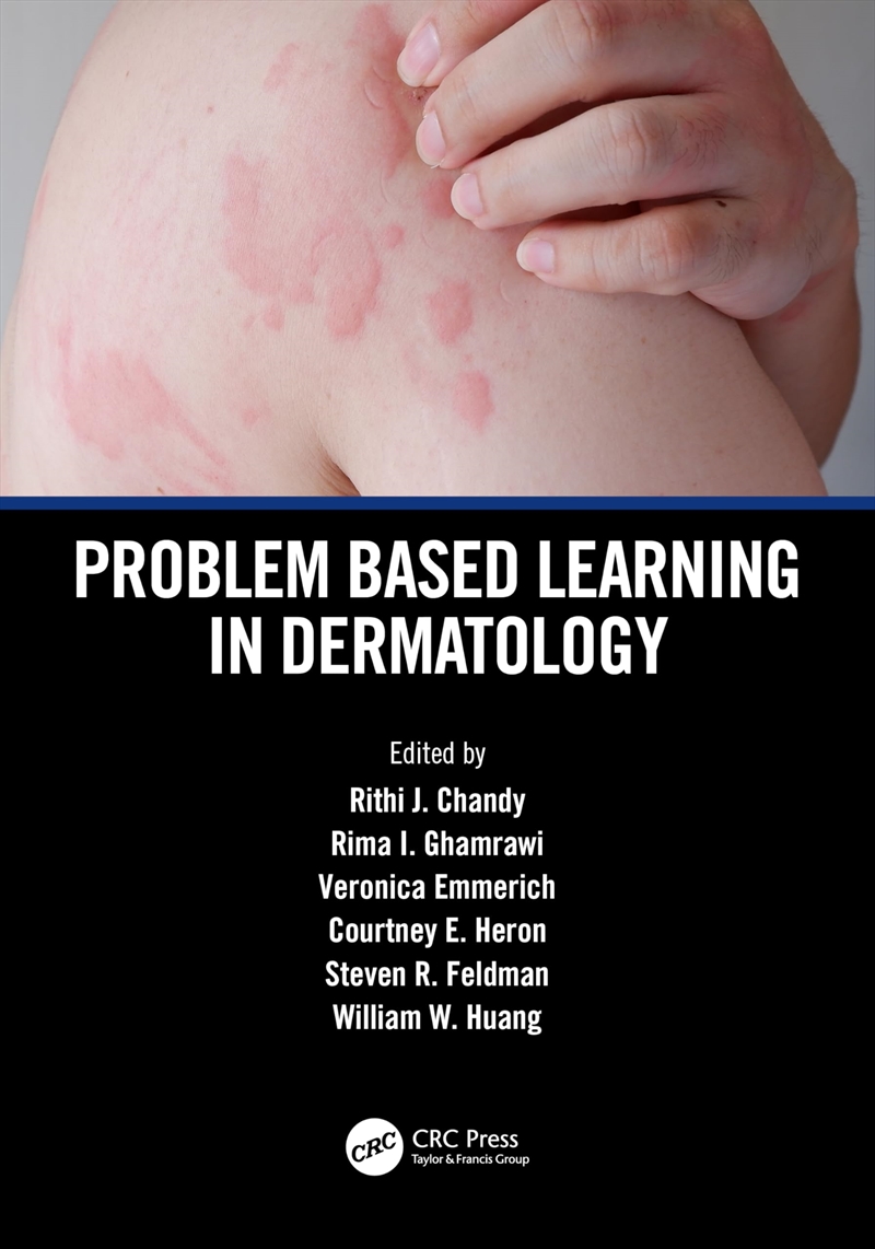 Problem Based Learning In Dermatology/Product Detail/Science
