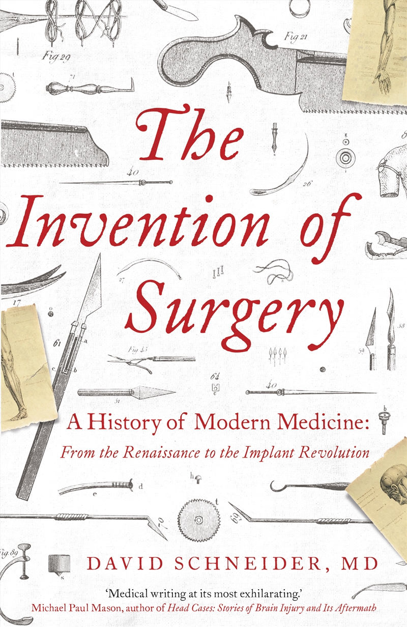 The Invention of Surgery/Product Detail/Science