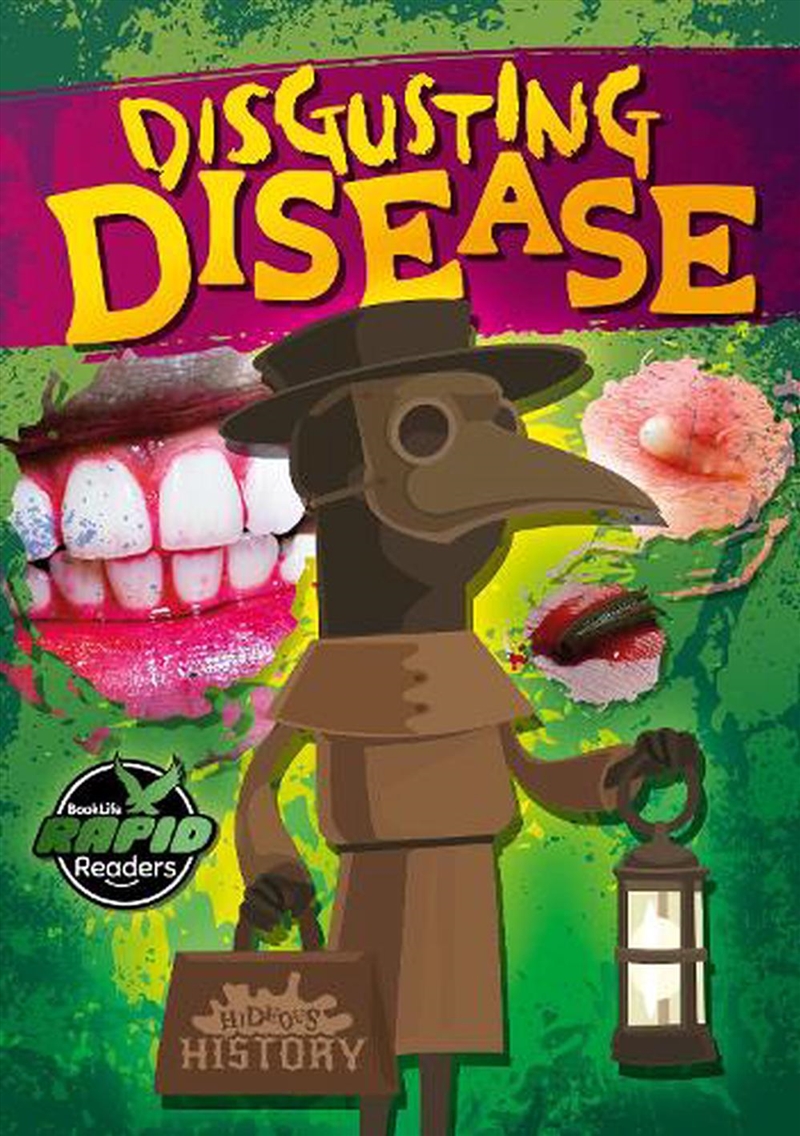 Disgusting Disease/Product Detail/Childrens Fiction Books