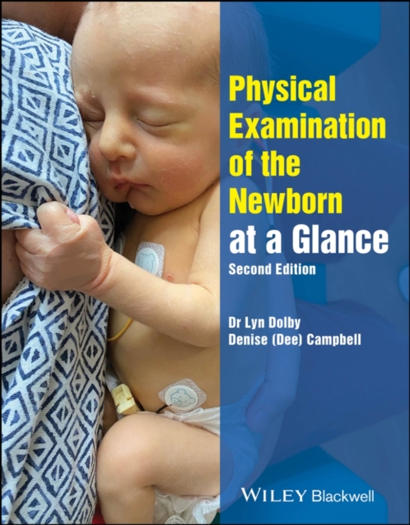 Physical Examination Of The Newborn At A Glance/Product Detail/Science
