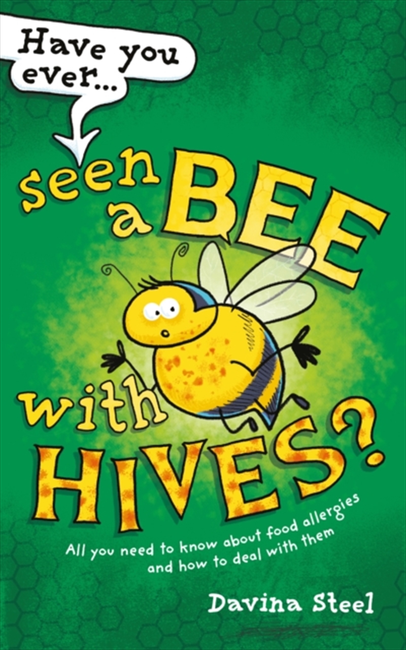 Have You Ever Seen A Bee With Hives? : All You Need To Know About Food Allergies And How To Deal Wit/Product Detail/Fitness, Diet & Weightloss