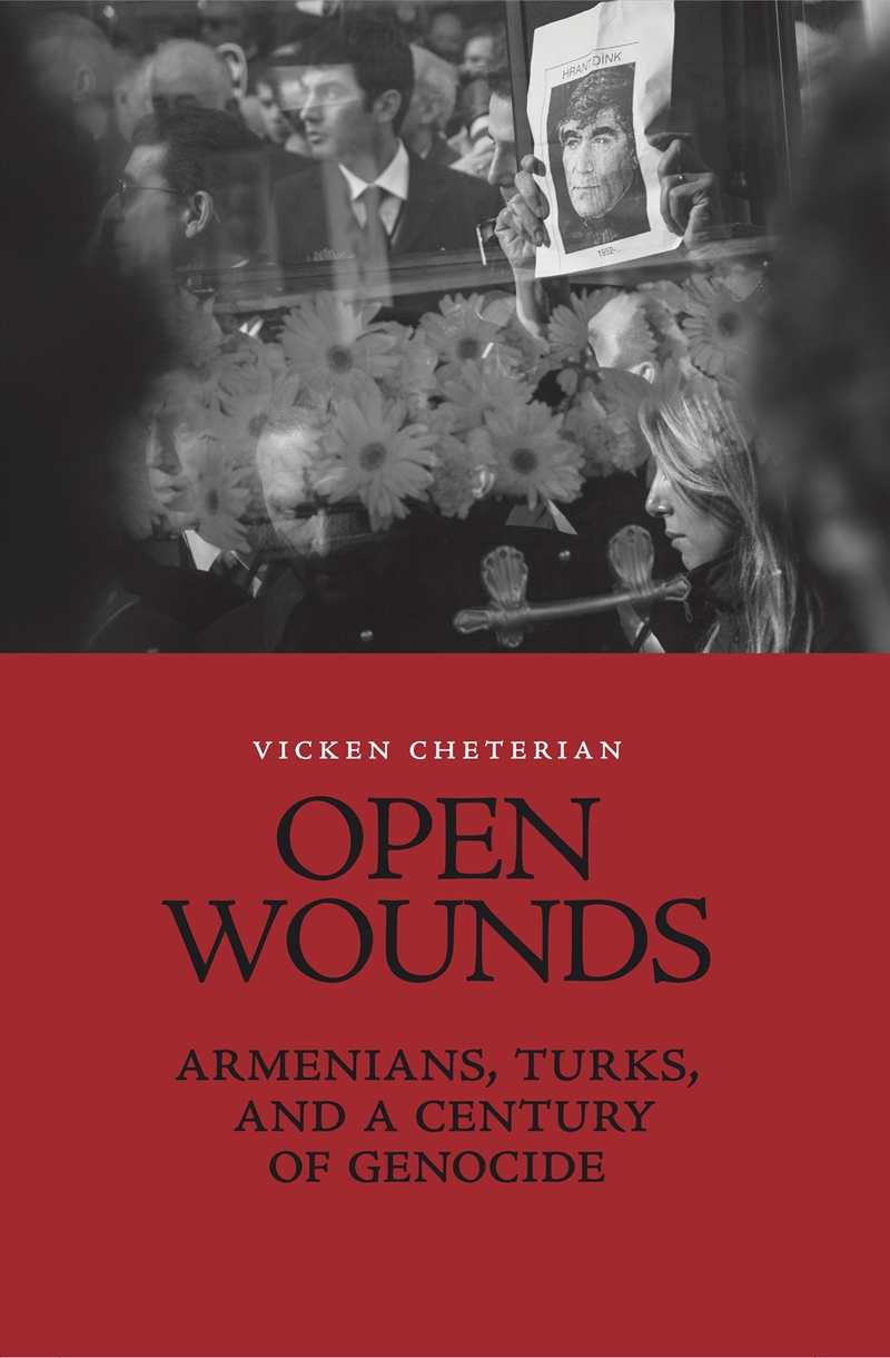 Open Wounds/Product Detail/History