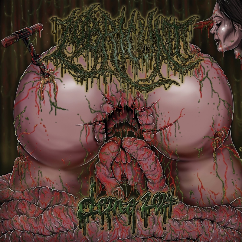 Demo 2024/Product Detail/Metal