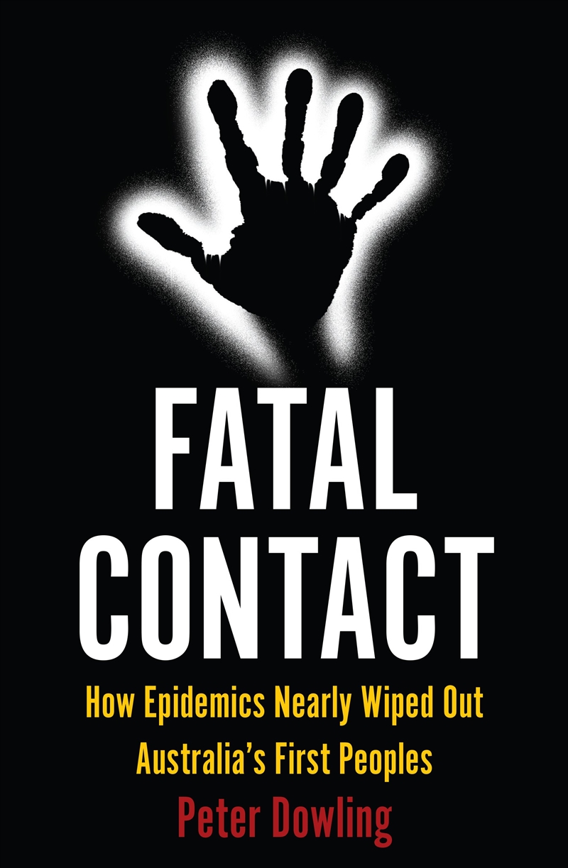 Fatal Contact/Product Detail/History