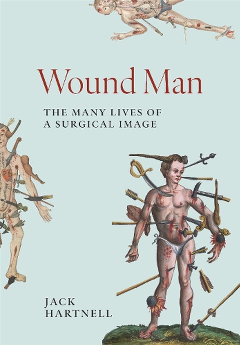 Wound Man/Product Detail/Family & Health
