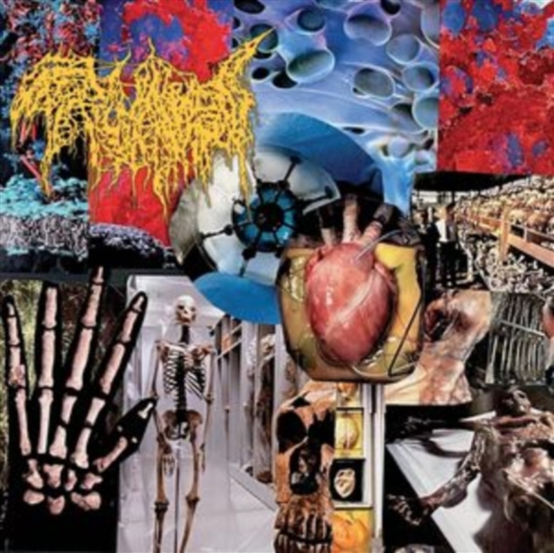 Harvest Of The Killing Fields/Product Detail/Metal
